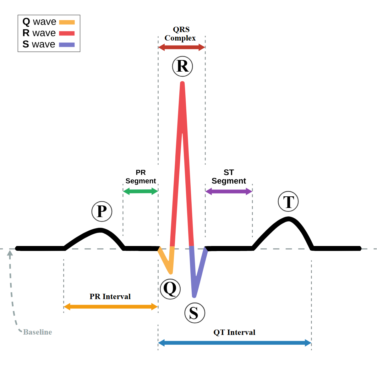 Standard ECG Complex Waves and Intervals